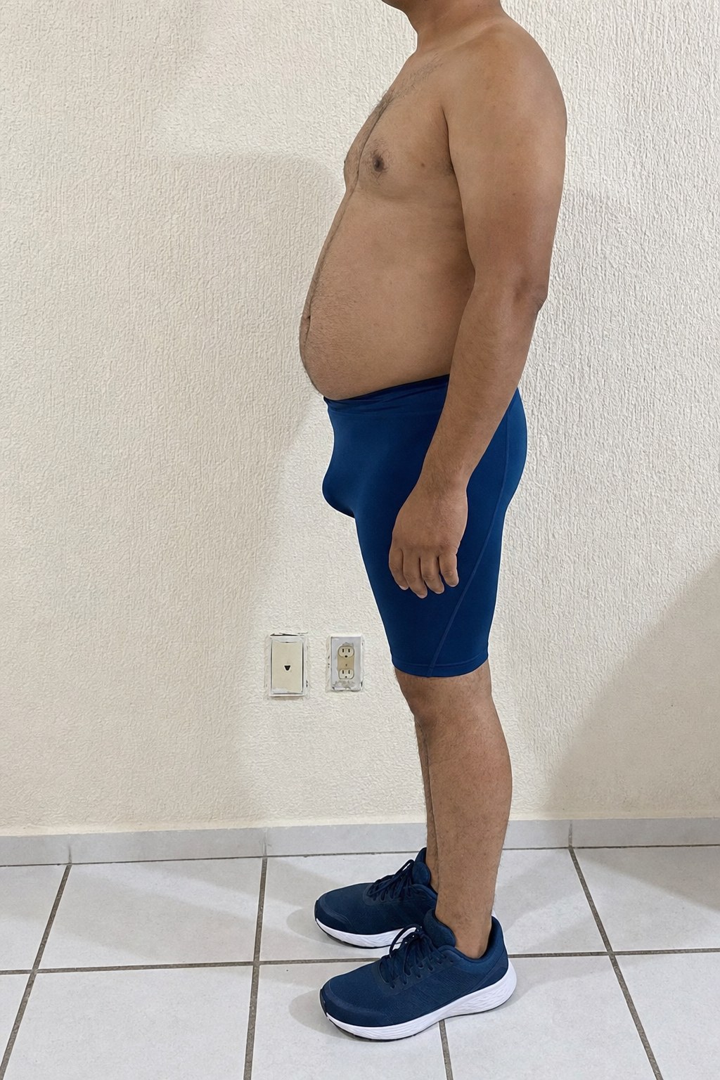 ANTES